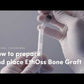Ethoss® Synthetic Bone Graft Material