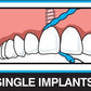 Idontix X-Floss Lite Thin Dental Floss - 30 Strands